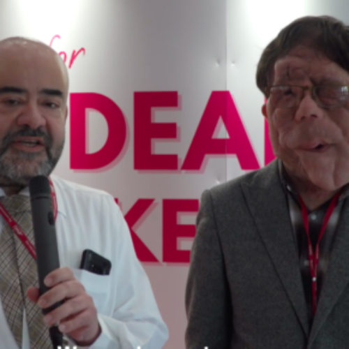 Actor & Disability Activist Adam Pearson at CWU Equality Day Image